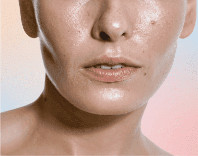 Oily Skin