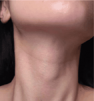 Tech Neck