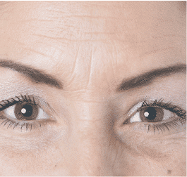 Anti-Aging