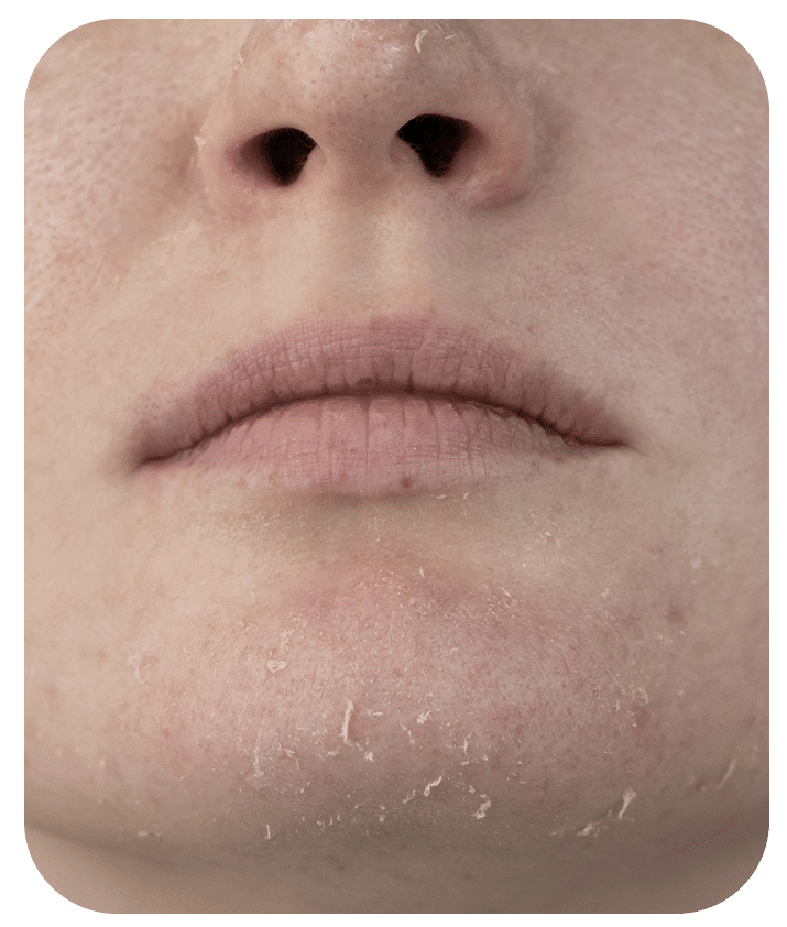 Designed to address Dry Skin