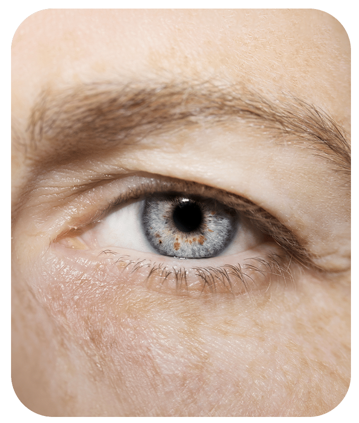Designed to address Saggy Eyelids