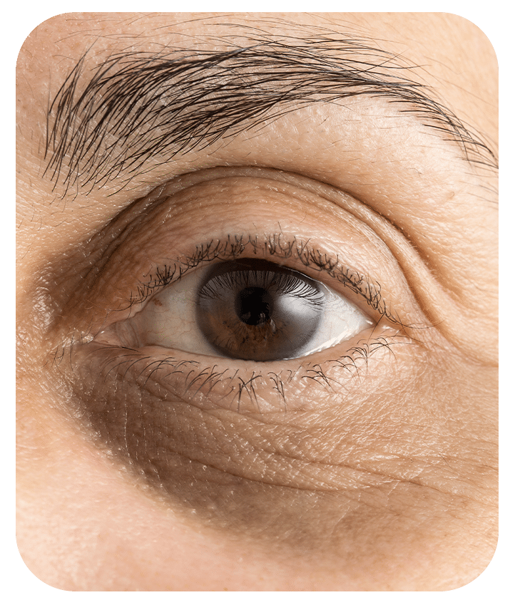 Designed to address Dark Circles