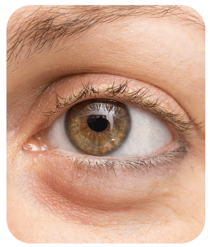 Designed to address Eye Bags