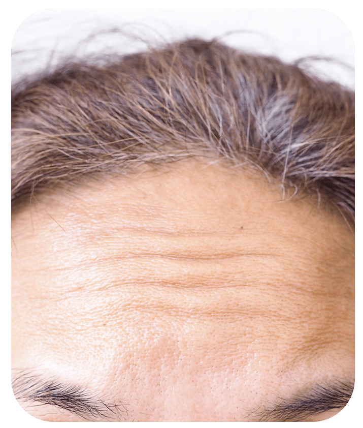 Designed to address Wrinkles