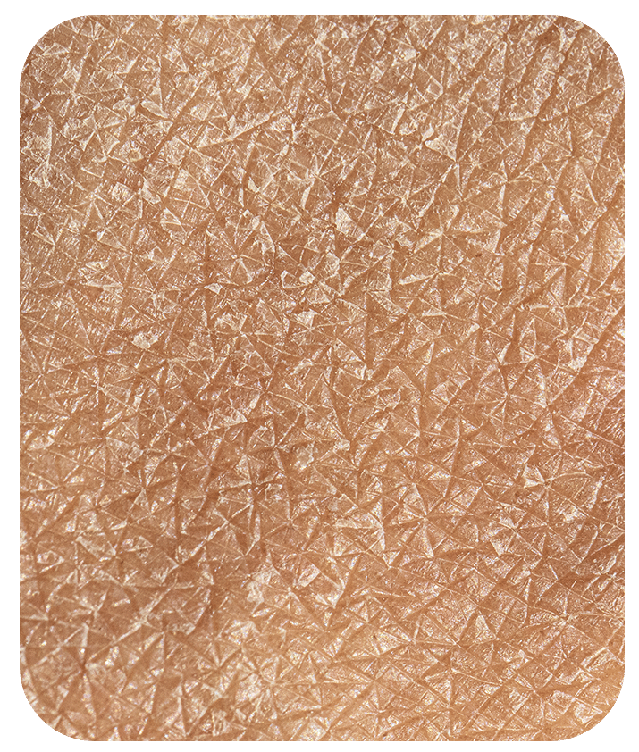 Designed to address Dry & Dehydrated Skin