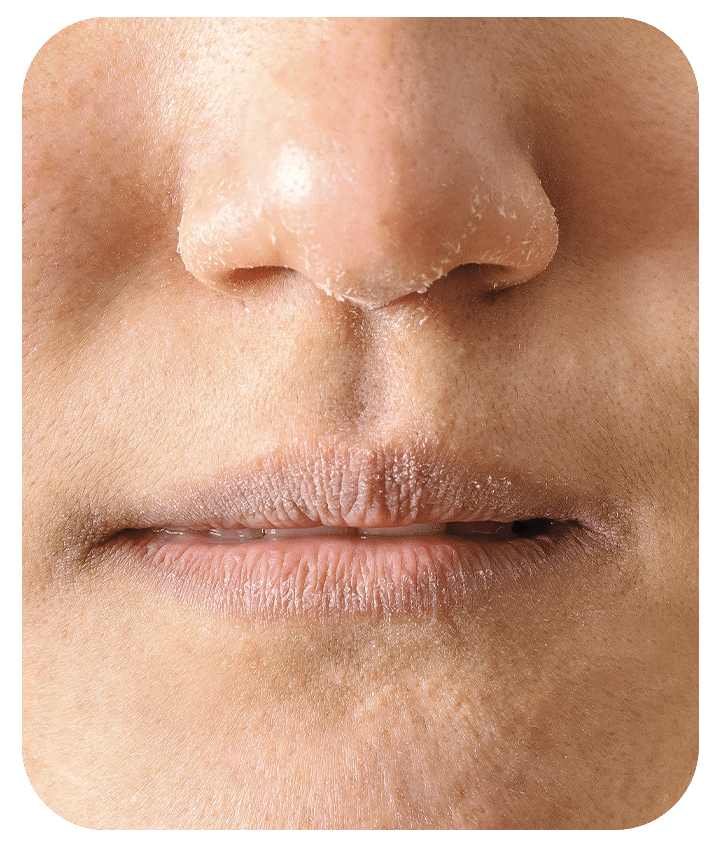 Designed to address Dull Skin