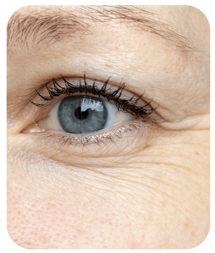 Designed to address Skin Texture