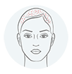 Targeting Dandruff