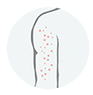 Targeting Keratosis pilaris