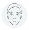 Targeting Melasma