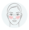 Targeting Seb derm