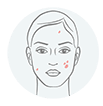 Targeting Skin cancer