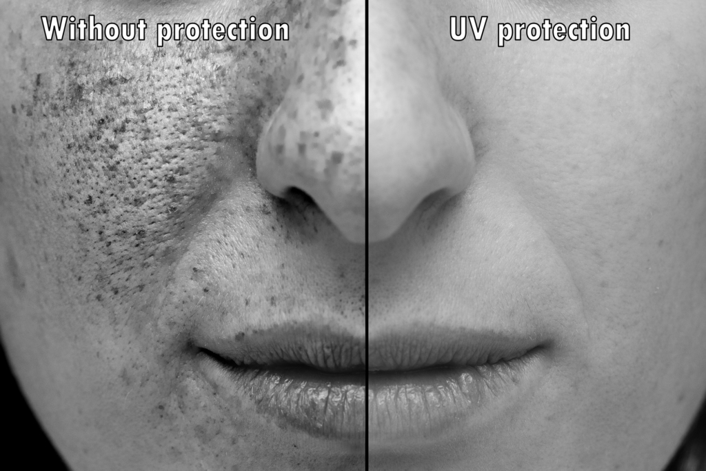 3 Signs of Sun-Damaged Skin & How to Reverse It