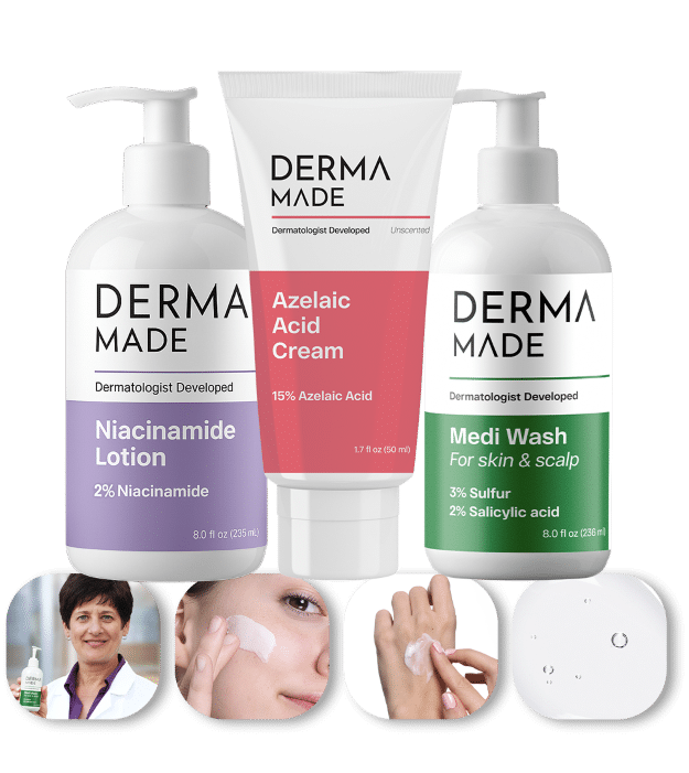 Rosacea Protocol main image