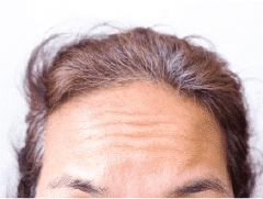 Wrinkles and Folds