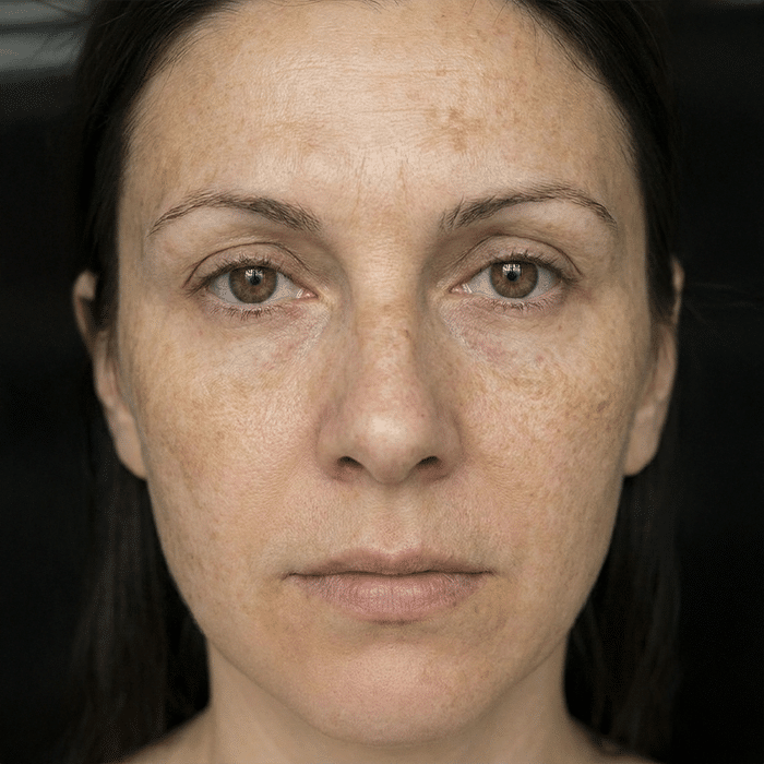 Women showing Reduce Dark Spots